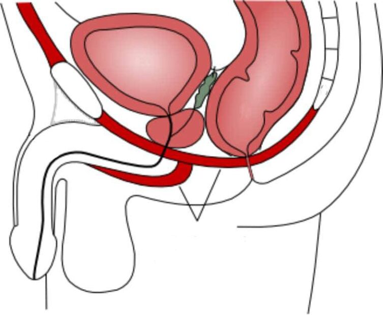 allenare i muscoli del pavimento pelvico per migliorare la potenza